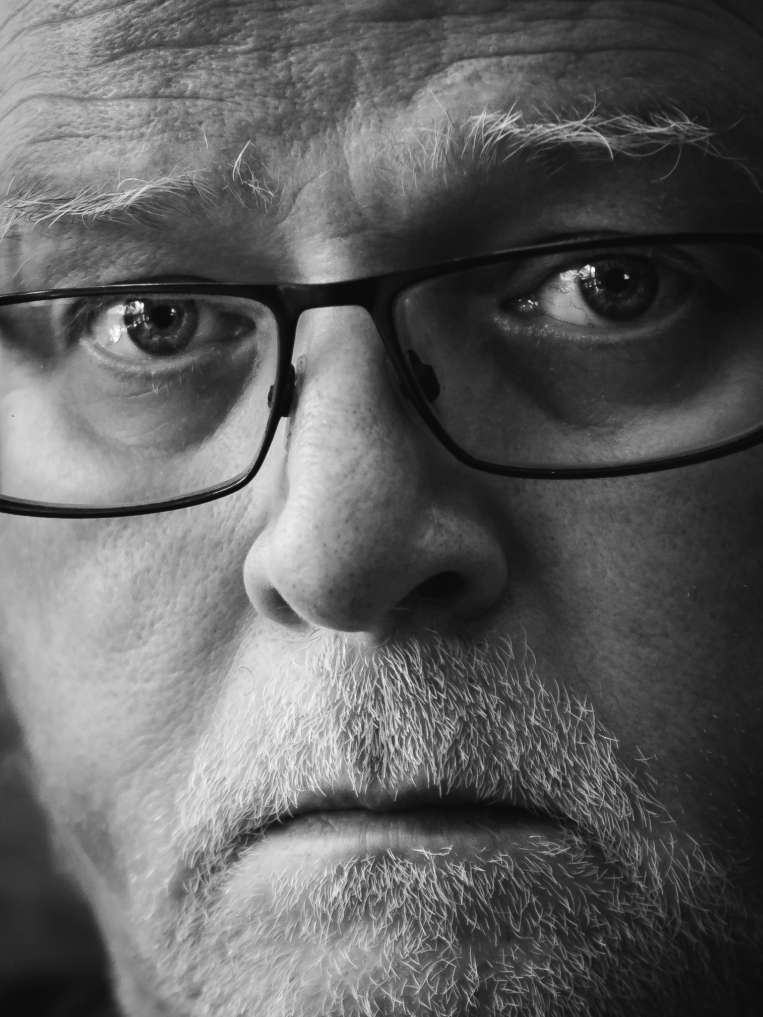 Selbstporträt vor Herz-OP